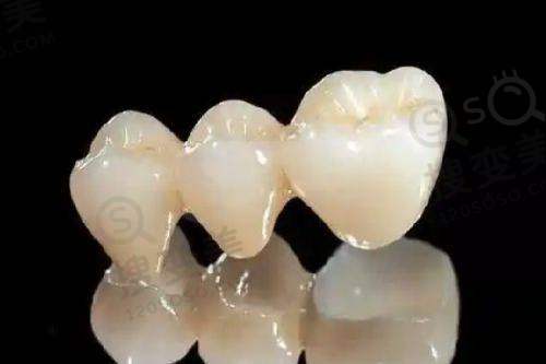 9、上海中博惠众口腔医院真人口碑评价怎么样?