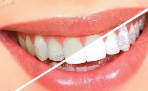 8、广州德伦口腔门诊部详细的预约挂号方式及流程