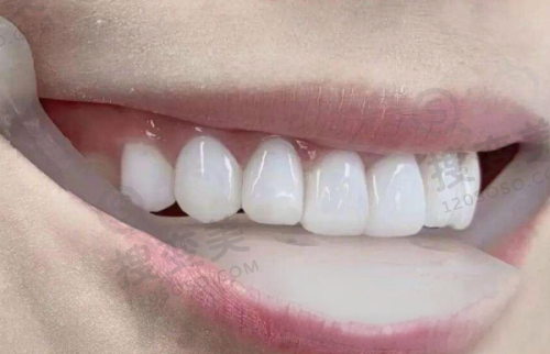 6、北京朗瑞紫金口腔门诊收费价格表/收费标准