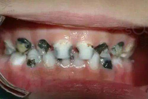 8、沈阳沈河威尔默口腔门诊部详细的预约挂号方式及流程