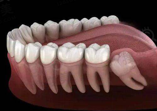 杭州口腔医院丁桥院区上班时间 - 结合优势看诊