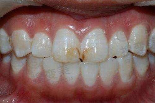 杭州口腔医院丁桥院区上班时间 - 特殊时段调整