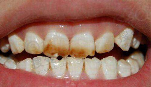 2、衡水博纳口腔门诊是正规医院吗？