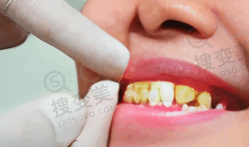 5、莆田荔城卓氏口腔门诊部医生团队实力强大及骨干医生简介