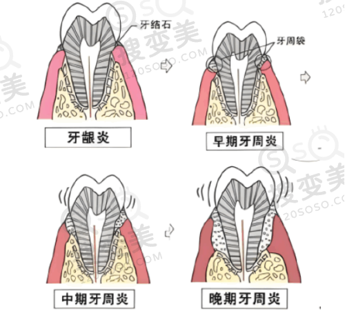 8、广州悦美口腔诊所详细的预约挂号方式及流程