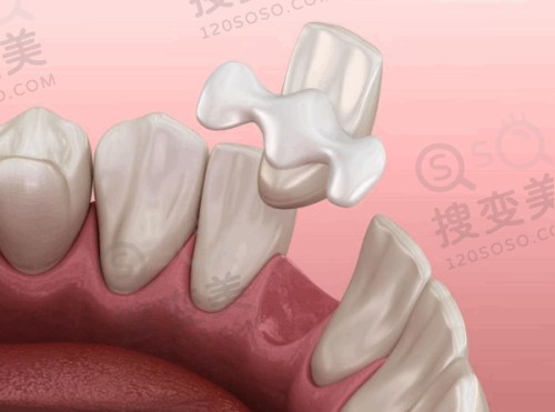 8、宁夏银川诺贝尔口腔医院详细的预约挂号方式及流程