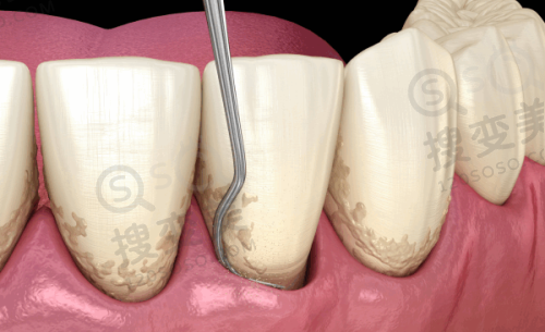 5、杭州钱塘牙科医院医生团队实力强大及骨干医生简介