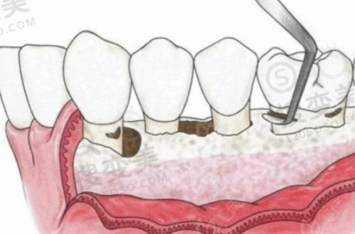 2、深圳新一坂田口腔诊所是正规医院吗?