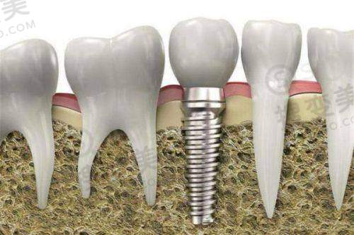 6、上海华尔康中博普众口腔医院收费价格表/收费标准