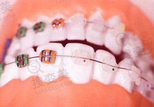 9、上海华尔康中博普众口腔医院真人口碑评价怎么样?