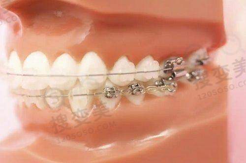 2、衢州柯城宝康口腔门诊部是正规医院吗?