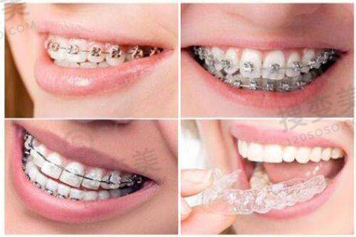 9、广州德伦口腔门诊部真人口碑评价怎么样?