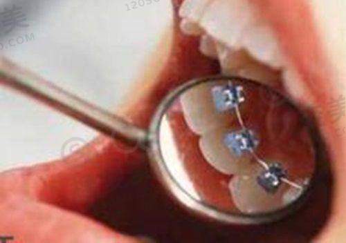 5、北京雅德嘉口腔（世纪城分院）医生团队实力强大及骨干医生简介