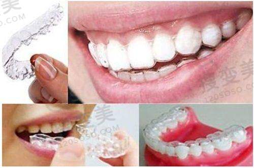 8、宜宾美尔口腔诊所详细的预约挂号方式及流程