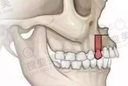 4、兰州皓正口腔诊所特色项目及技术优势