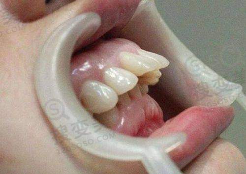 9、深圳同步齿科真人口碑评价怎么样？