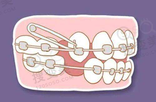 7、深圳同步齿科地址电话营业时间