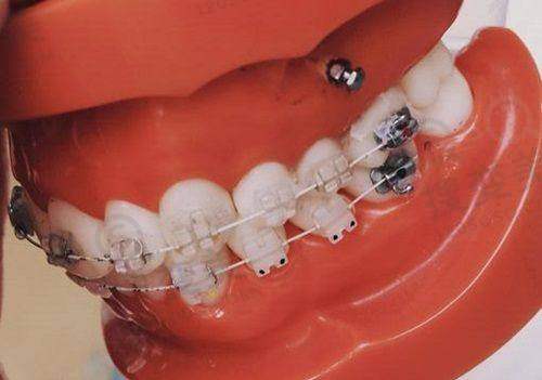 6、深圳同步齿科收费价格表/收费标准