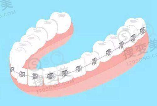 8、上海上远妙镜口腔门诊部详细的预约挂号方式及流程