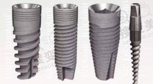 4、大庆蒋氏口腔医院特色项目及技术优势