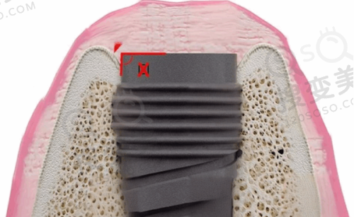 北大口腔魏公村总院2025超全挂号方式之现场挂号预约