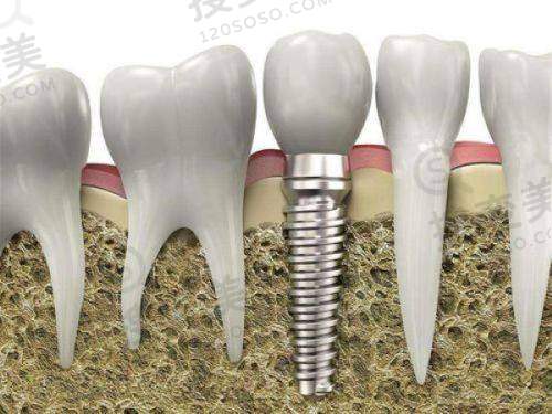 6、莆田荔城卓氏口腔门诊部收费价格表/收费标准