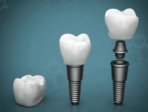 9、遵义和美口腔门诊部真人口碑评价怎么样?