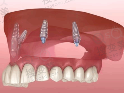 7、石狮星雅口腔门诊部地址电话营业时间