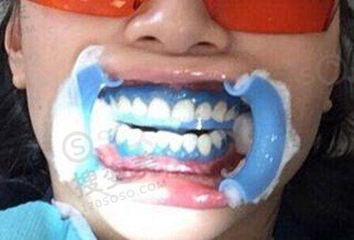 5、深圳柏齿康口腔医生团队实力强大及骨干医生简介