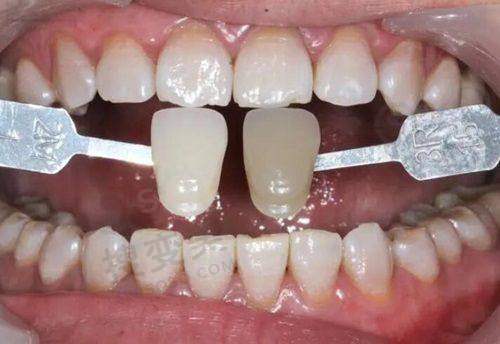 2、北京金武门口腔门诊部是正规医院吗?