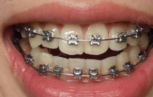 5、杭州瑞创口腔萧山市心北路口腔门诊部医生团队实力强大及骨干医生简介