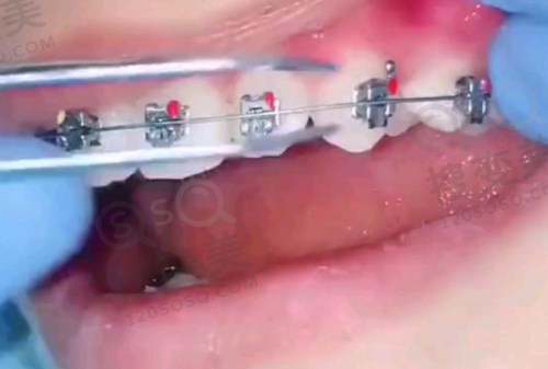 7、杭州钱塘牙科医院地址电话营业时间