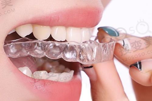 6、深圳柏齿康口腔医院收费价格表/收费标准