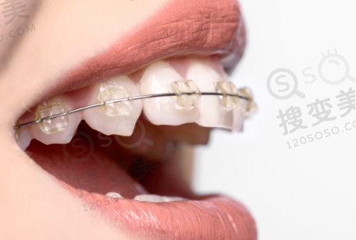 8、巴中时代口腔诊所详细的预约挂号方式及流程