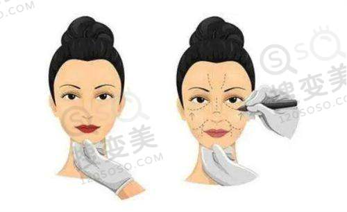 上海馥兰朵董磊隆胸口碑评价