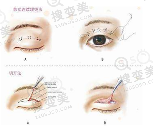 上海馥兰朵医院是正规医院吗?资质三重认证,陈超群鼻修复技术强口碑好