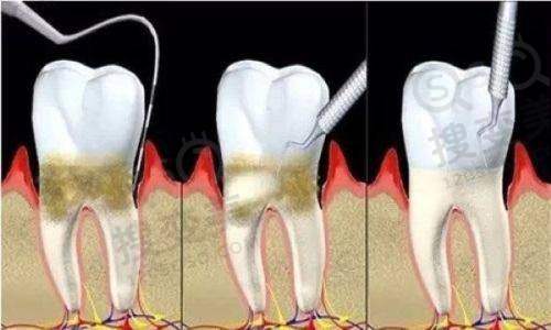 公开北京中诺口腔医院价格表