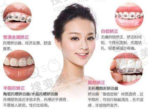 公开北京中诺口腔医院地铁乘坐路线