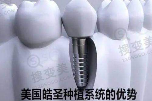 成都英博口腔医院种植牙怎么样?种抄植牙技术硬核!种植牙医生+价格公布——种植技术优势