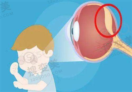 乌鲁木齐普瑞眼科口碑怎么样?在当地口碑良好深受眼科患者信赖和认可之费用情况与优惠活动
