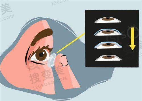 上海眼科医院哪家好?上海眼科医院排名前十的医院之上海麦迪格视光眼科