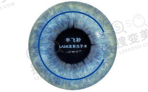 郑州爱尔眼科医院挂号预约:多渠道可约,游昌涛等医师坐诊还有价格参考