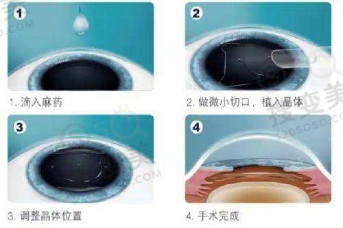 上海眼科医院哪家好?上海眼科医院排名前十的医院之上海润尔眼科门诊部