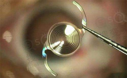 武汉爱尔眼科医院武昌总院上班时间及挂号方式