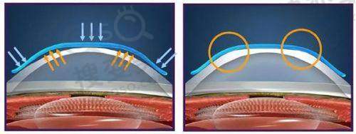 武汉爱尔眼科医院地址在哪里?武昌总院中山路481号,网上预约全攻略