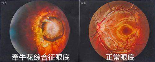 乌鲁木齐普瑞眼科口碑怎么样?在当地口碑良好深受眼科患者信赖和认可之与其他医院对比优势