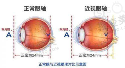 上海眼科医院哪家好?上海眼科医院排名前十的医院之上海新视界中兴眼科医院