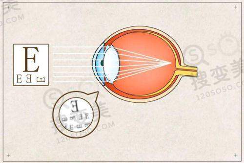 2025北京同仁医院眼科医生排名榜:排名依据与意义
