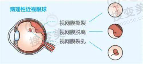 郑州爱尔眼科医院电话是多少?400 电话抄公布 1 地址+预约挂号方式一键收藏——医院地址及交通路线