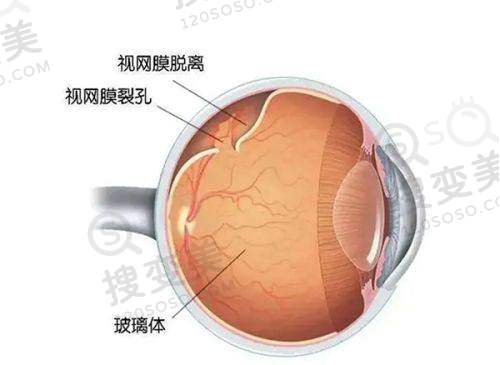 郑州爱尔眼科医院电话是多少?400电话公布,游昌涛做近视手术,预约方式一键收藏